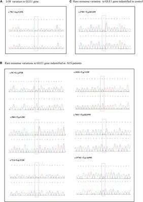 Mutation Screening of the GLE1 Gene in a Large Chinese Cohort of Amyotrophic Lateral Sclerosis Patients